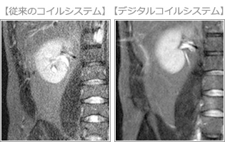 デジタルコイルシステム